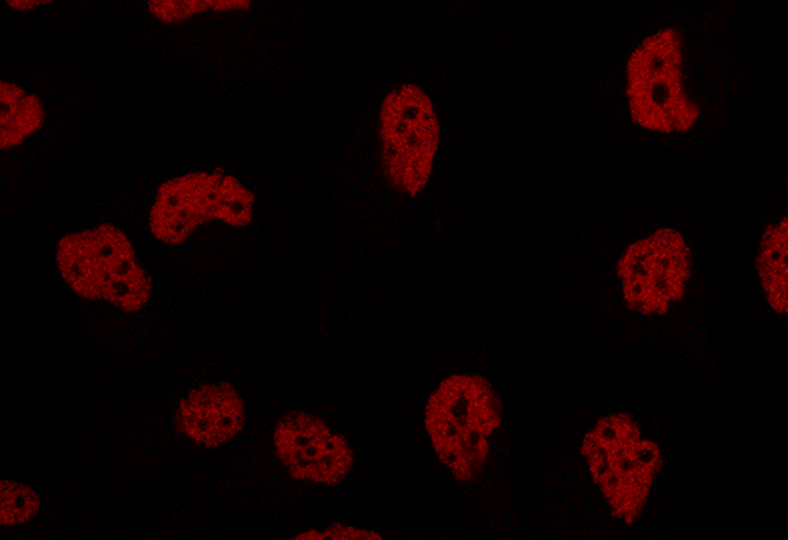 Triple negative breast cancer cells RED