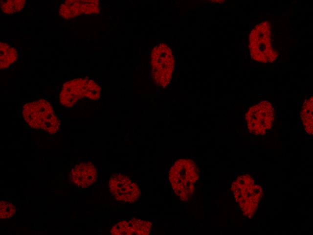 Triple negative breast cancer cells RED