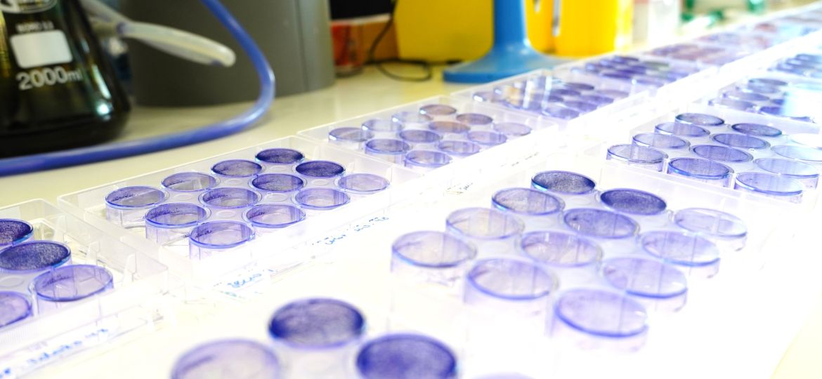 Filler lab VHIO