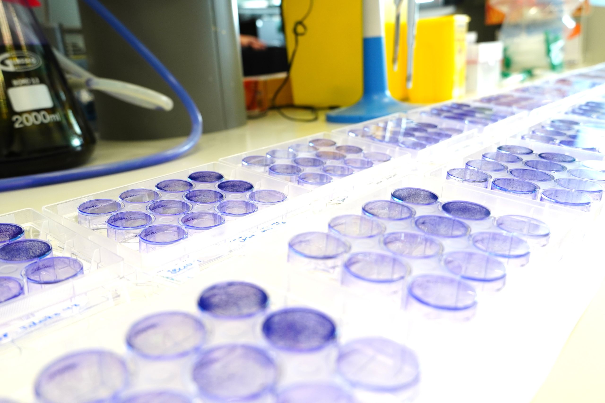 Filler lab VHIO